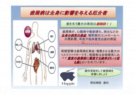 歯周病は全身に影響を与える厄介者